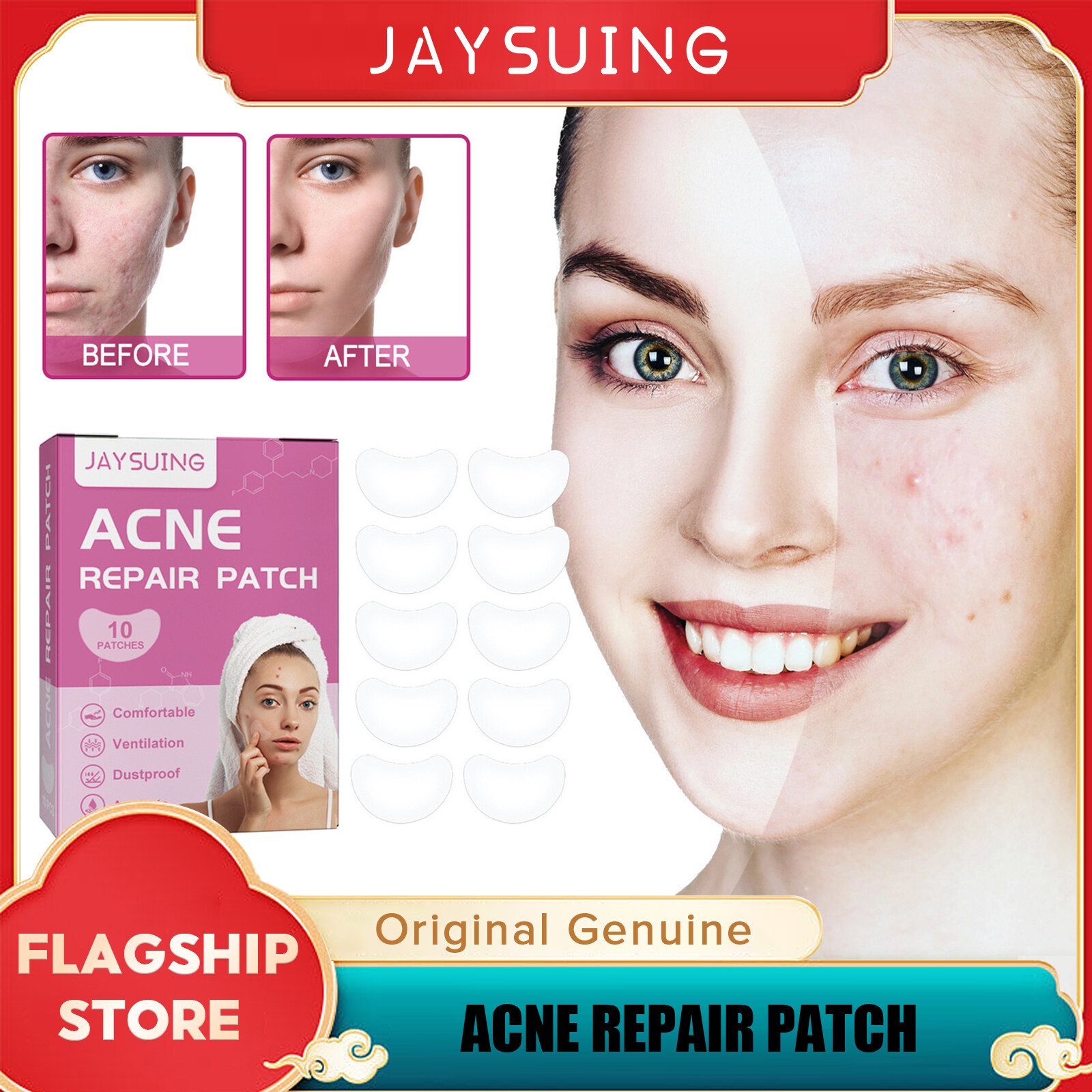 Jaysuing Waterproof Acne Repair Patch Skin Acne Patch Invisible ...