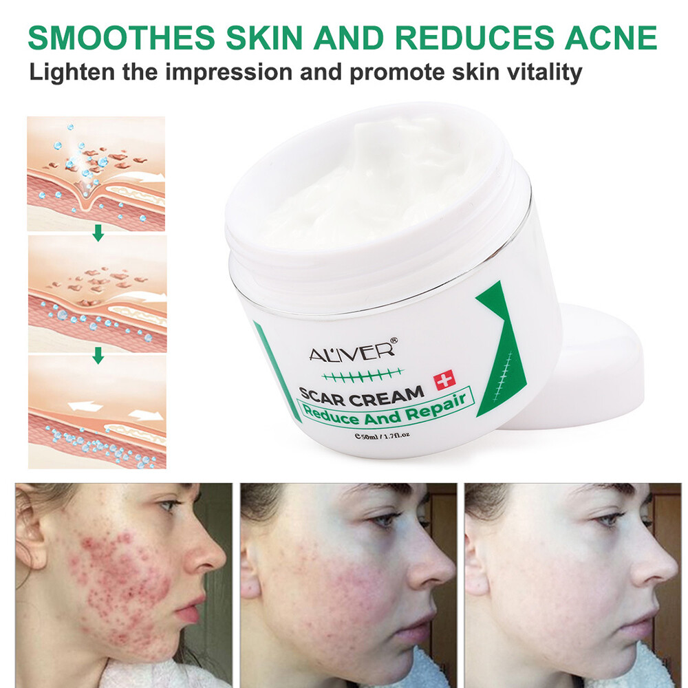 dermatologist cream