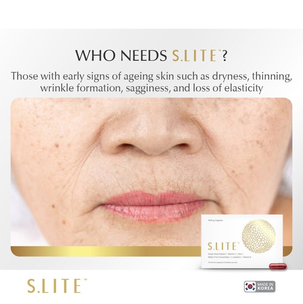 S.LITE™ (60 capsules) | Lazada