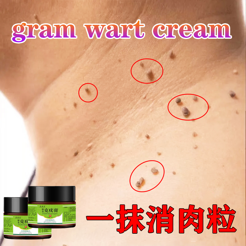 [Buy 3 get 2 free the same style]Wart remover cream Remove the small