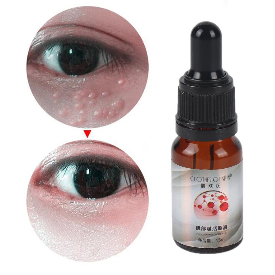 under eye wrinkle repair