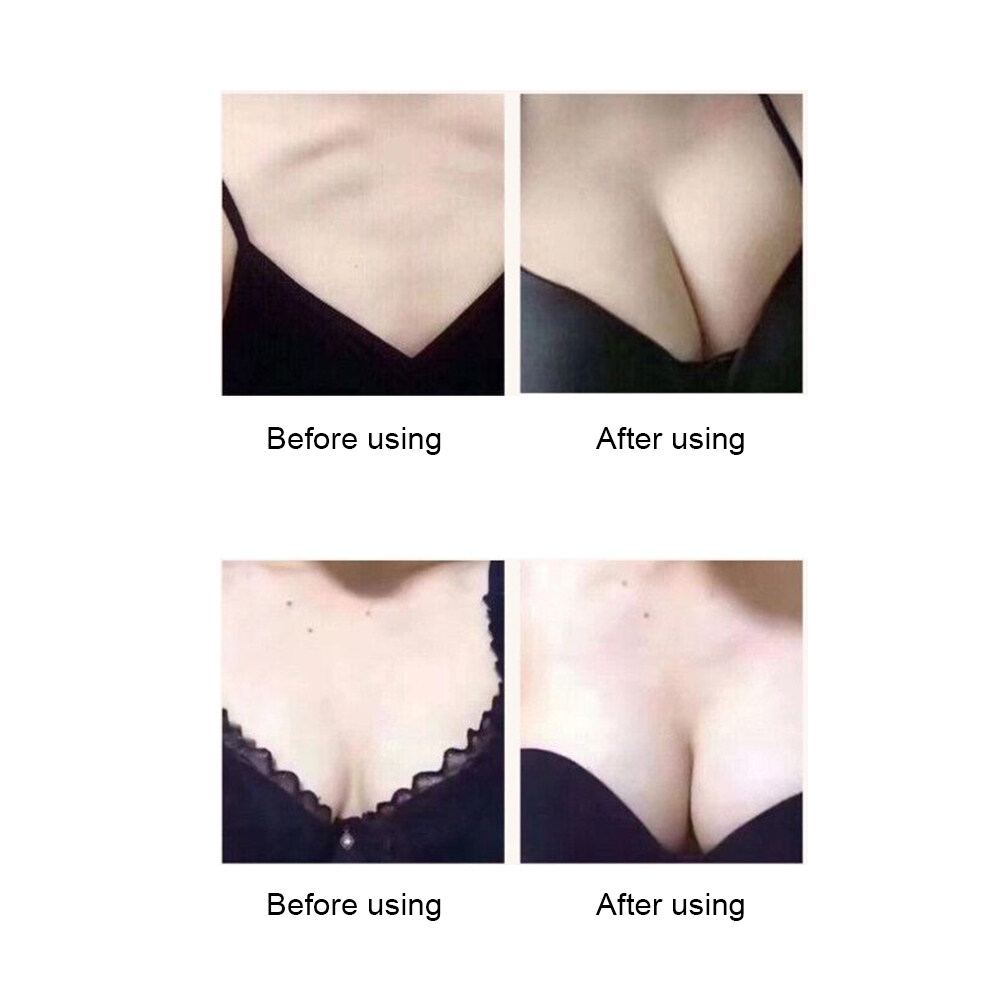 Vacuuming Breast Enlargement