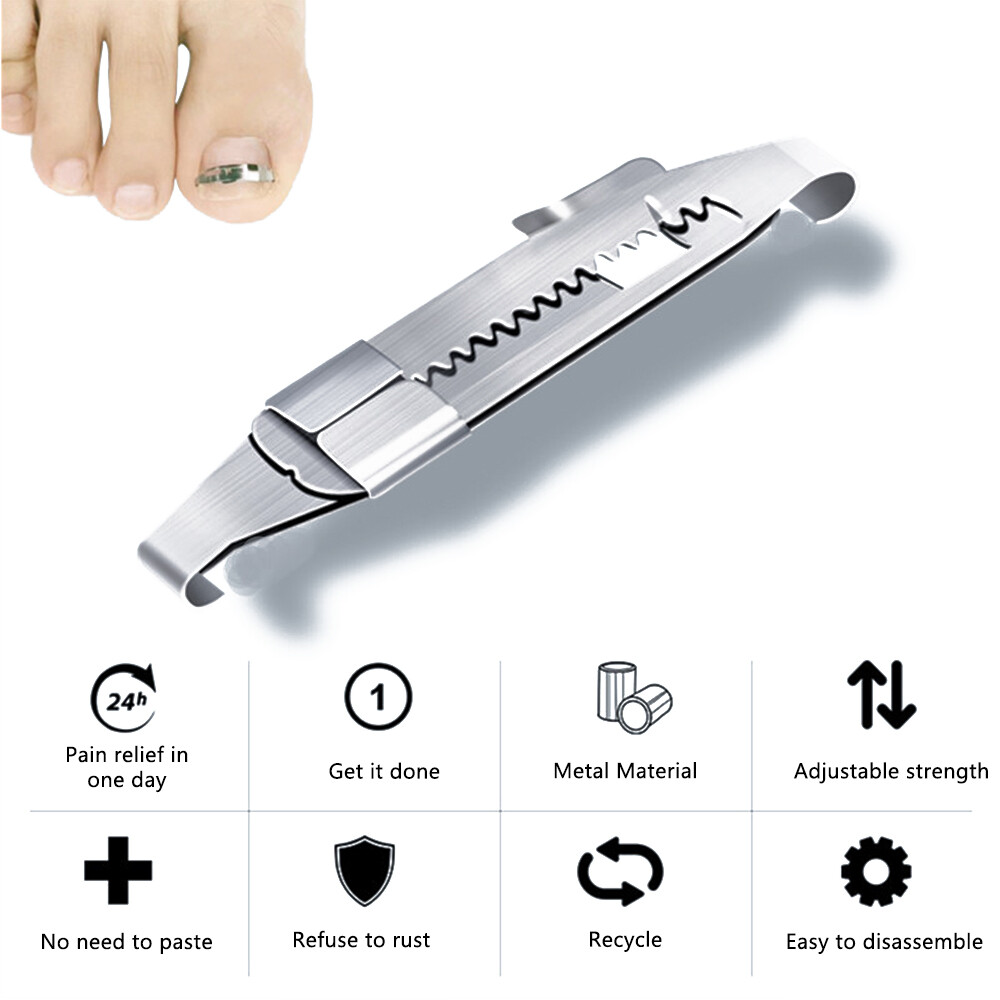 Ingrown Toe Nail Correction Tool Toenail Straightening Correctors Patch Tool