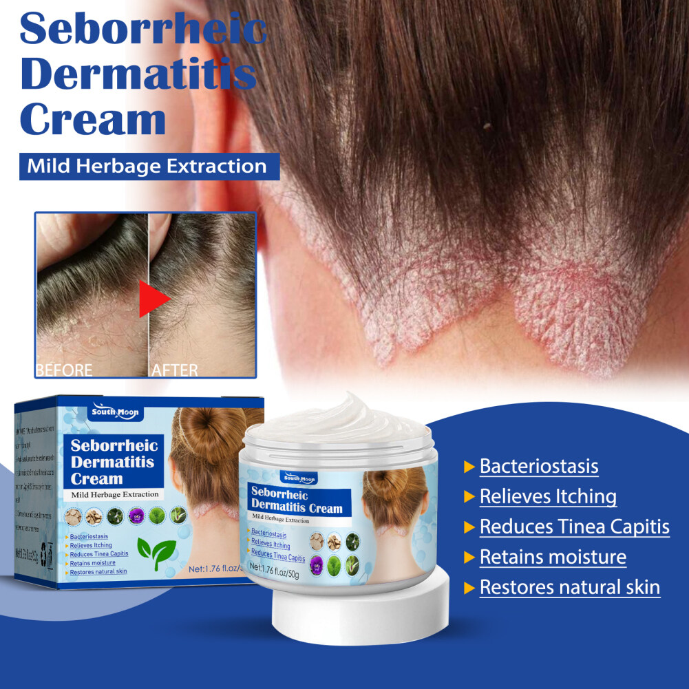 50g-south-moon-eczema-treatment-cream-psoriasis-ointment-eczema