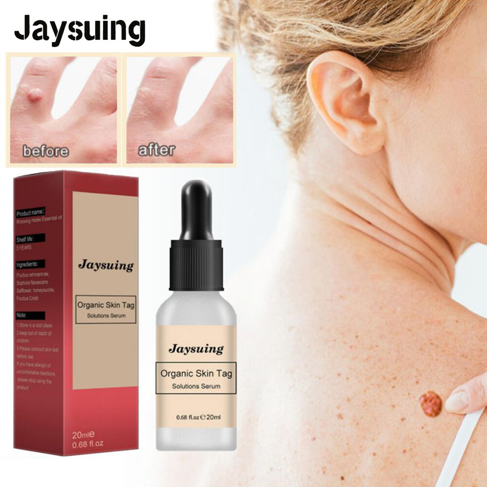 Jaysuing Skin Tag Remover Painless Mole Skin Dark Spot Wart Removal jaysuing-skin-tag-remover-painless-mole-skin-dark-spot-wart-removal