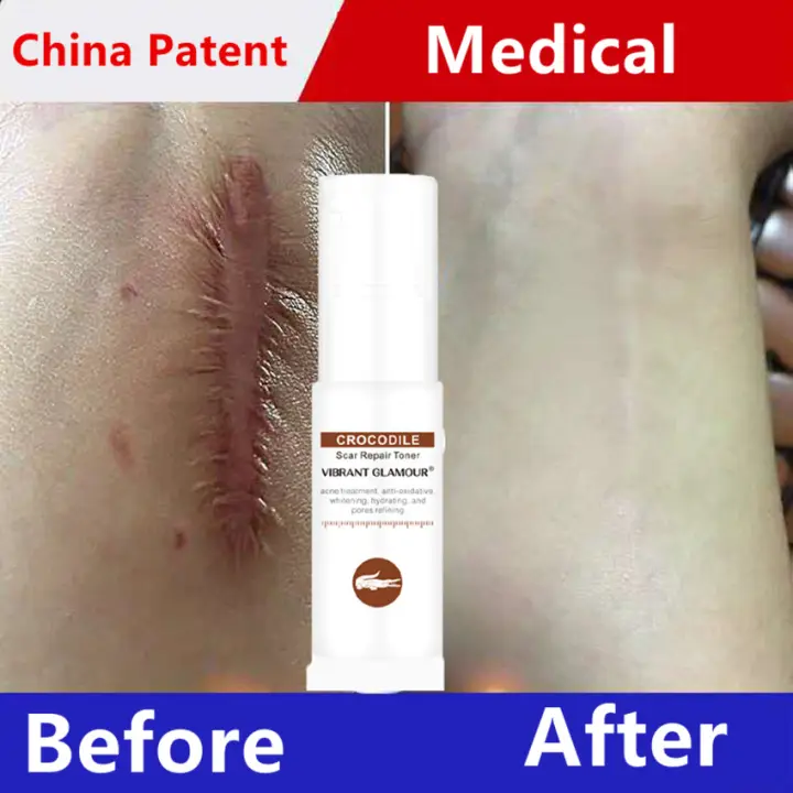 crocodile face toner