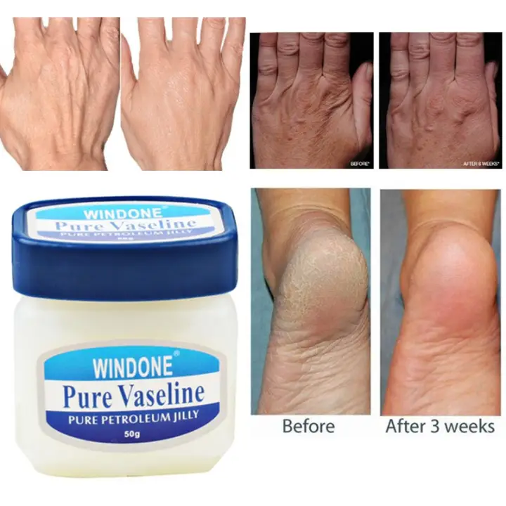 moisturizer for cracked hands