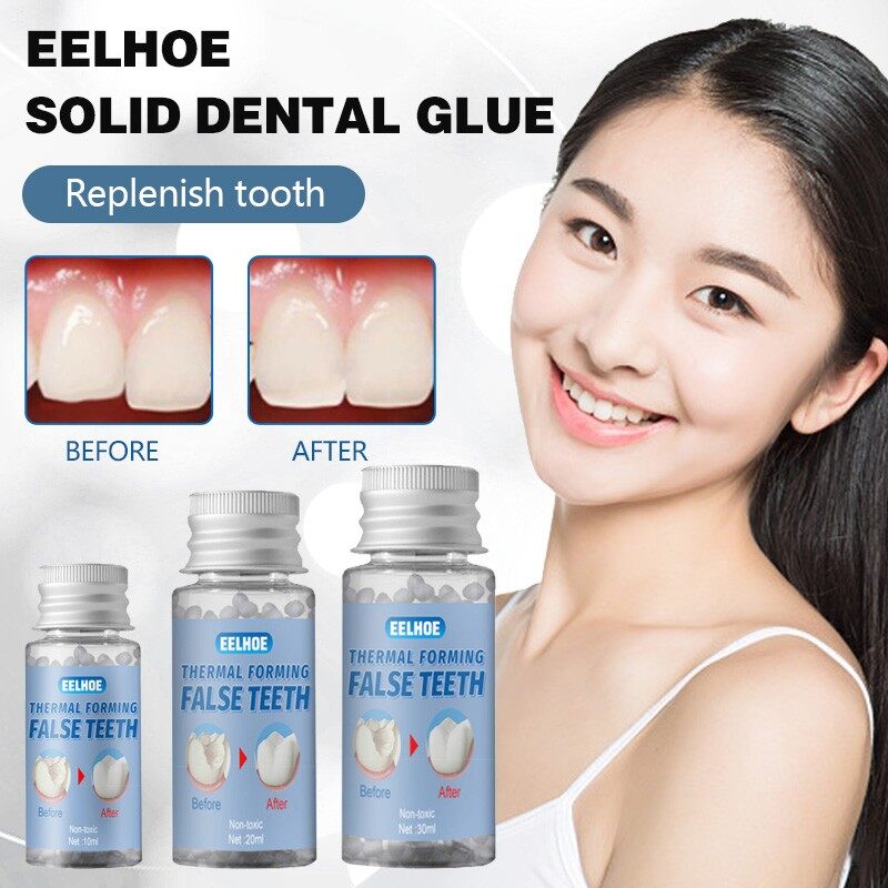 MOFE DIY Tooth Repair Replace Missing Denture Repair Solid Denture Temporary Tooth Filling Material Tooth Brace Rubber Safety Non-Toxic Moldable Replacement Material Tooth Repair Kit 10g/ 20g/ 30g