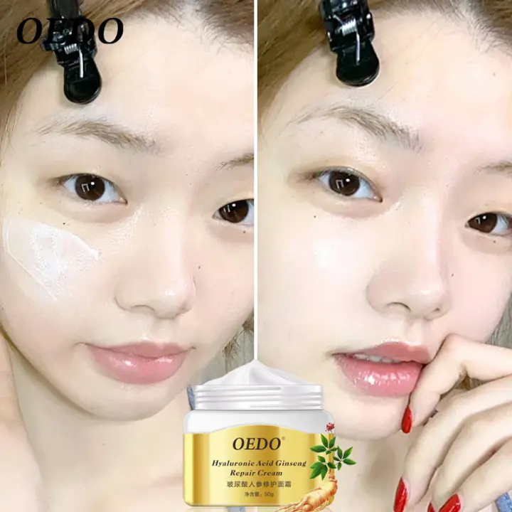 ginseng acne cream