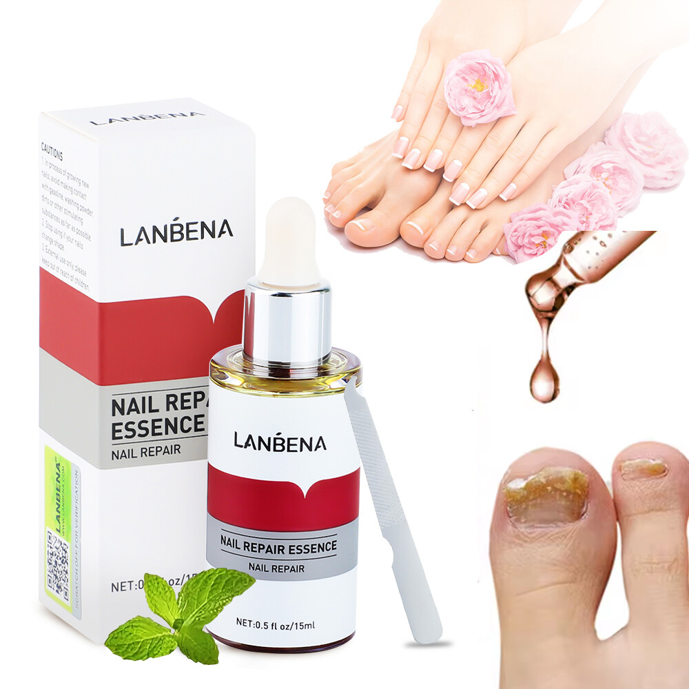 LANBENA Fungal Nail Repair Serum Treatment Foot Nail Fungus Removal Gel Anti Infection Paronychia Onychomycosis Essence Care