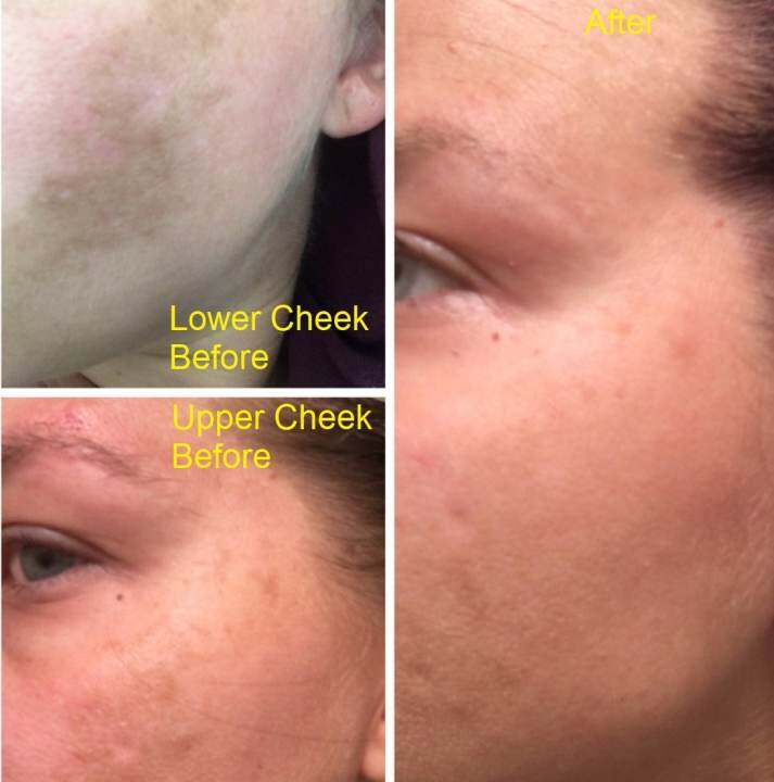 admire my skin serum