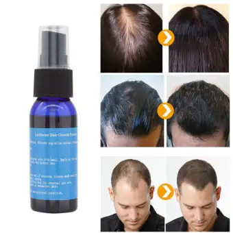 100 Original Unique Fast Sunburst Hair Growth Products Dense Hair