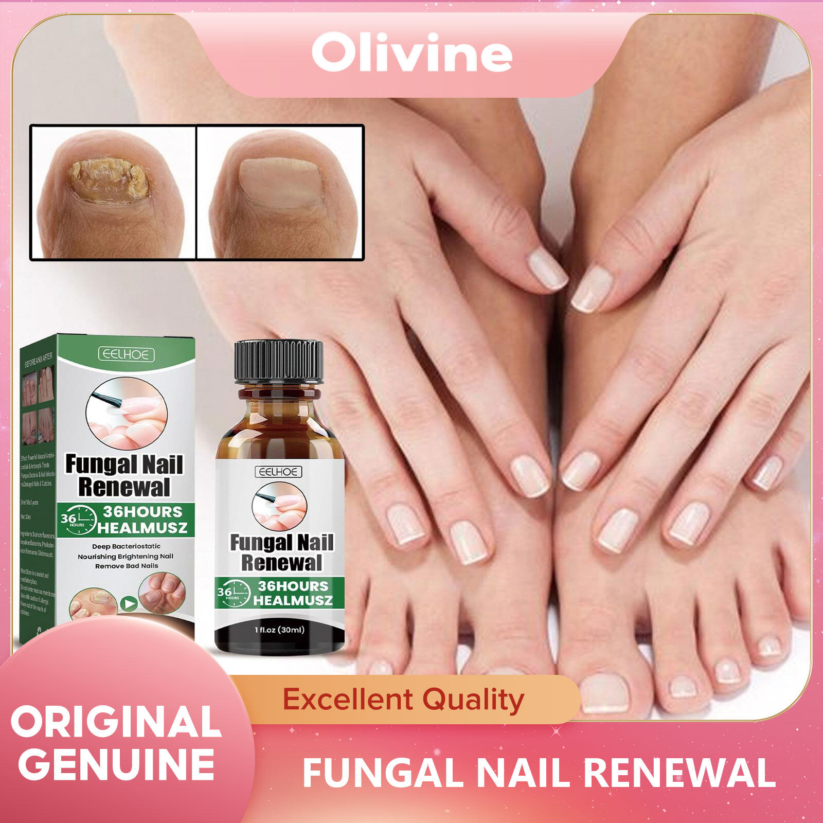 EELHOE Nail Fungus Repair Essence Fungal Toenail Renewal AntiInfective