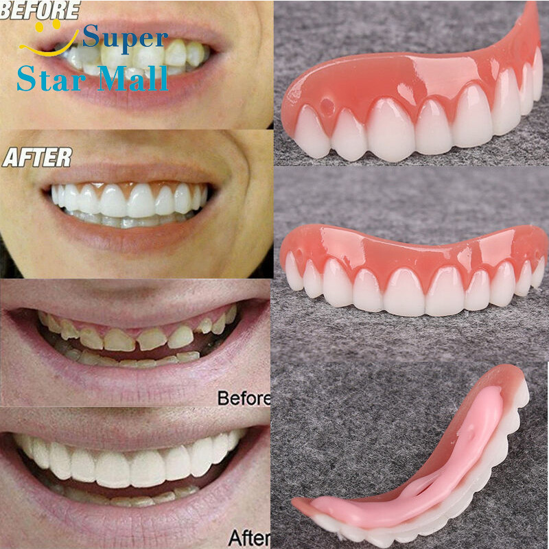 Super Star Mall Silicone Smile Veneers Simulation Braces Flex Denture Paste