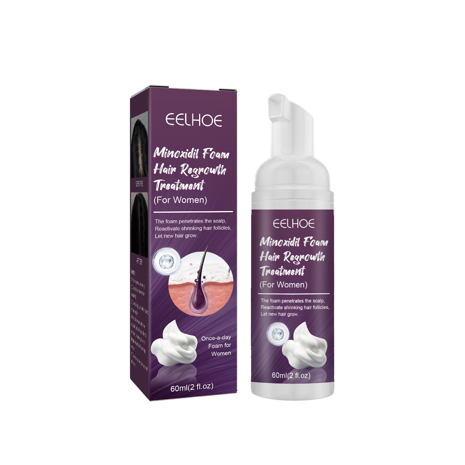 From Thinning Hair To Thick: My Chew Free Hair Regrowth - wmy69t6