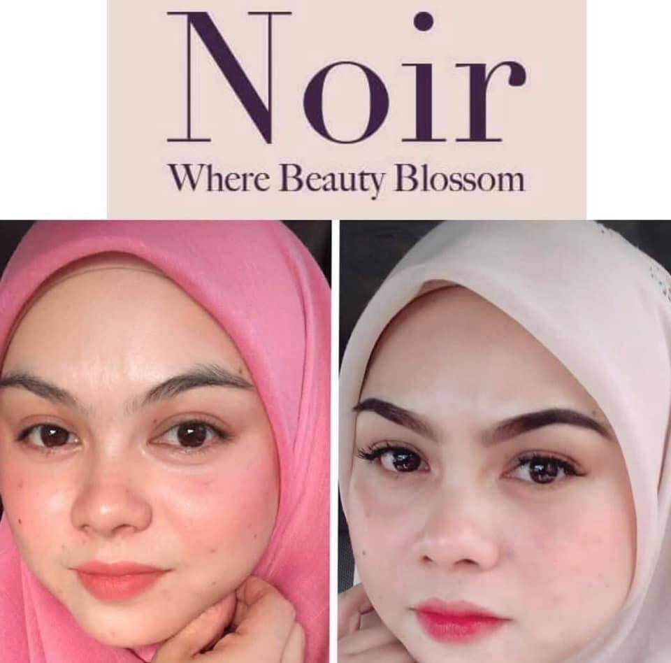 testimoni noir skincare