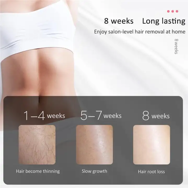 Electric Ipl 500000 Flashes Laser Epilator Depilation 5 Speed