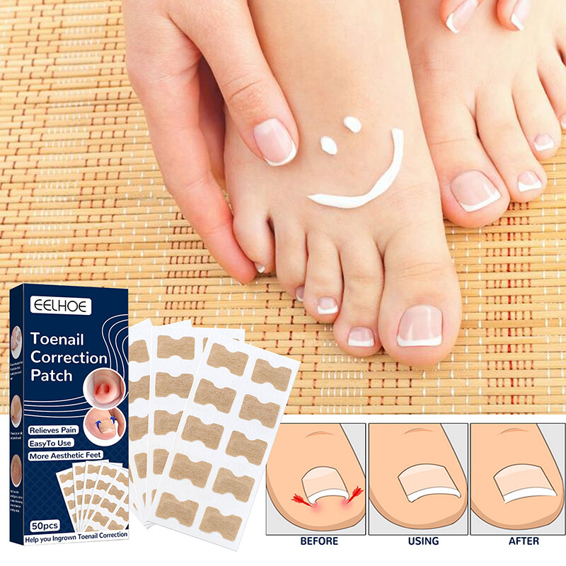 Ingrown Toenail Sticker with Toenail Planing Tool 50pcs Toenail Correction Patch Toe Correction Sticker Glue-Free Nail Corrector Patch