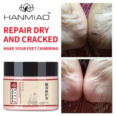 HANMIAO Aging skin repair cream repair cracked skin moisturizing repair function moisturizing cream skin repair