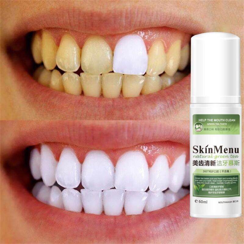COD Tinh Khiết Tự Nhiên Loại Bỏ Vết Bẩn Răng Vàng Răng Trắng Làm Sạch Miệng Phun 60ml