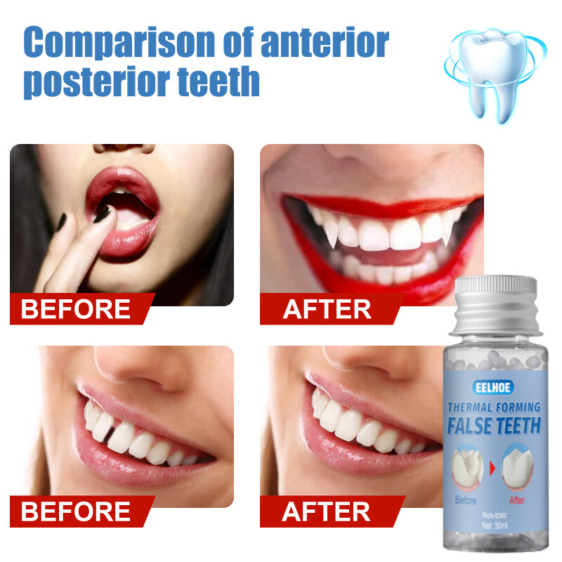 MOFE DIY Tooth Repair Replace Missing Denture Repair Solid Denture Temporary Tooth Filling Material Tooth Brace Rubber Safety Non-Toxic Moldable Replacement Material Tooth Repair Kit 10g/ 20g/ 30g