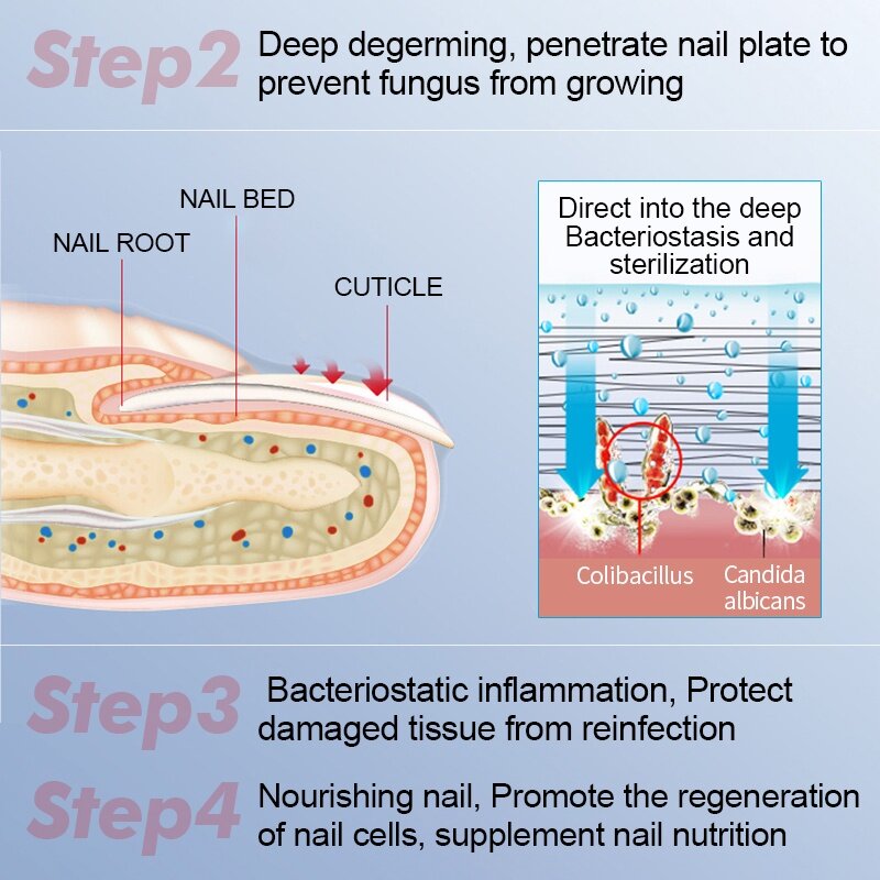 VIBRANT GLAMOUR Dưỡng Móng Tay Dài Và Cứng Nail Repair Serum Fungal Nail Treatment Essence Remove Onychomycosis Toe Nourishing Hand...