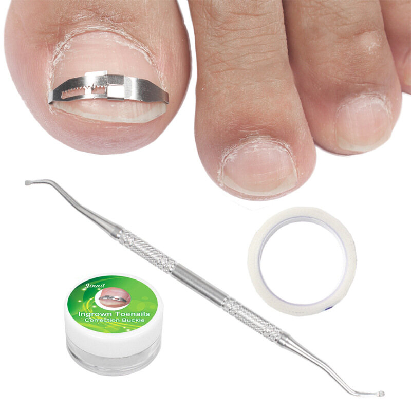 【 100% gốc + COD】Ingrown Chân Móng Tay Công Cụ Chỉnh Sửa Móng Chân Thẳng Hiệu Chuẩn Vá Bộ Công Cụ