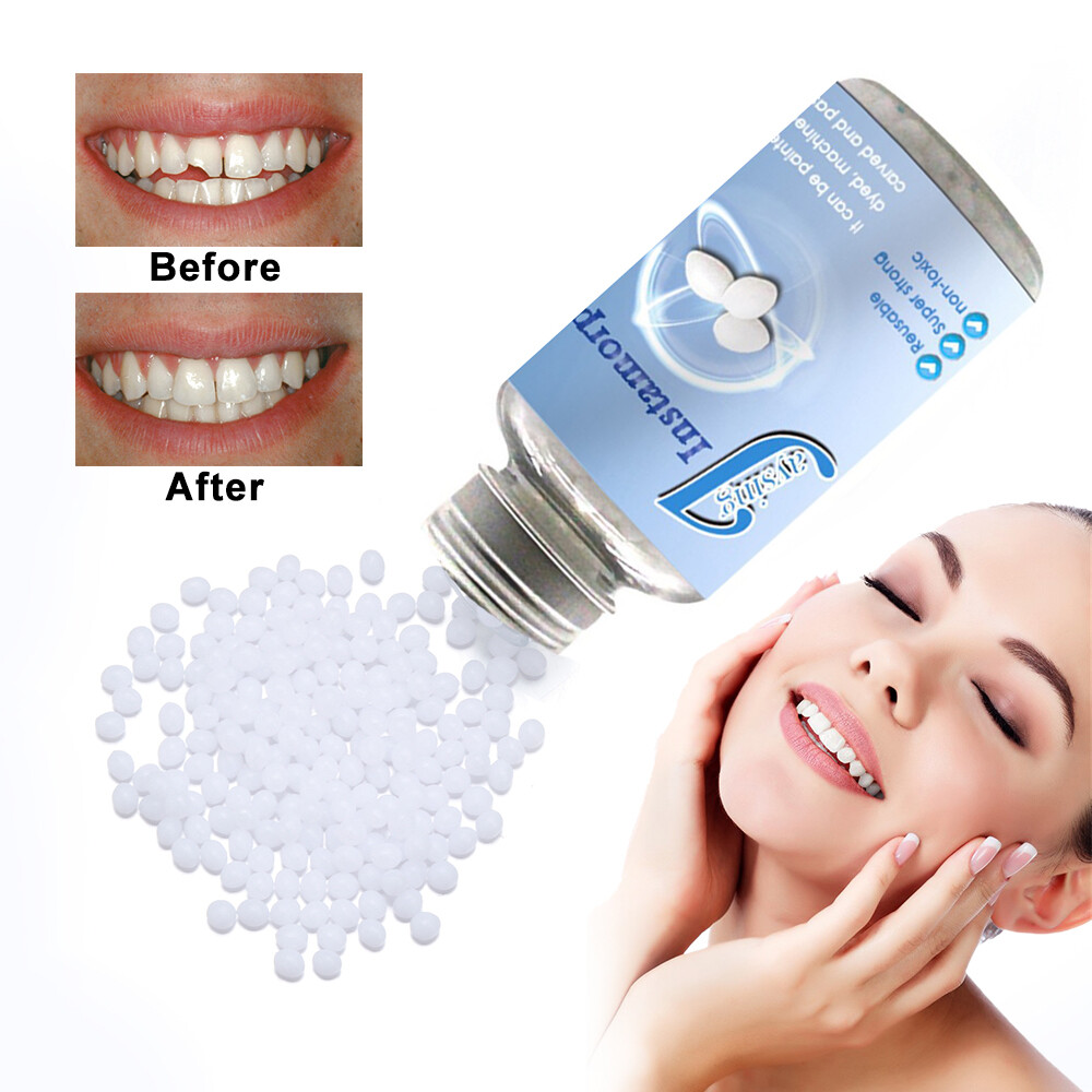 Vật Liệu Làm Đầy Răng Tạm Thời Răng Hàm Thay Thế Răng Giả Nha Khoa Bộ Đồ Nghề Điện Răng Giả Gel Răng Rắn Vật Liệu Thay Thế Răng