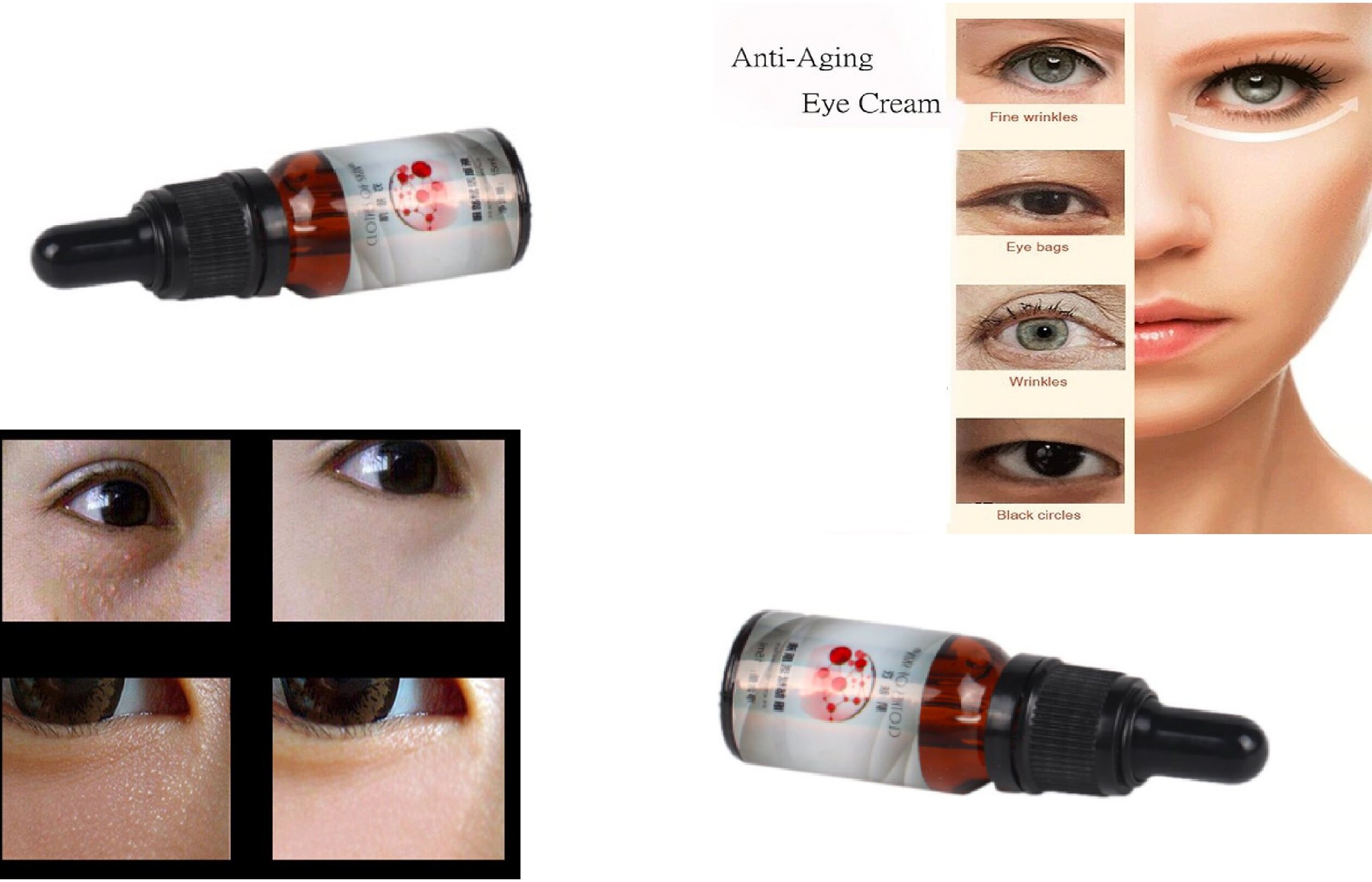 aging eyes treatment