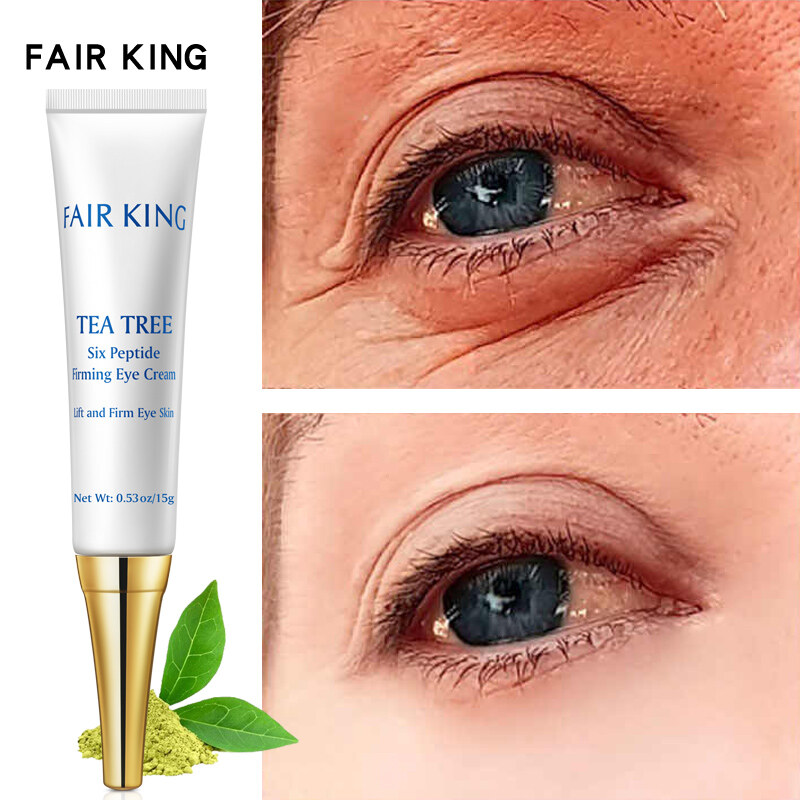 eye fair cream