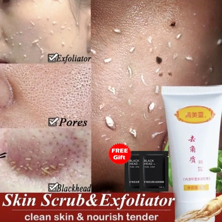 face peeling gel