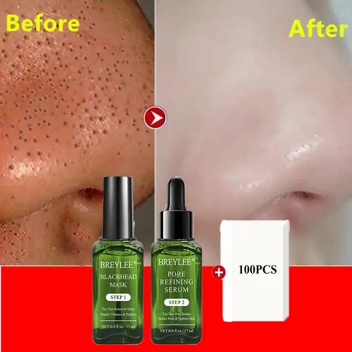 breylee blackhead serum