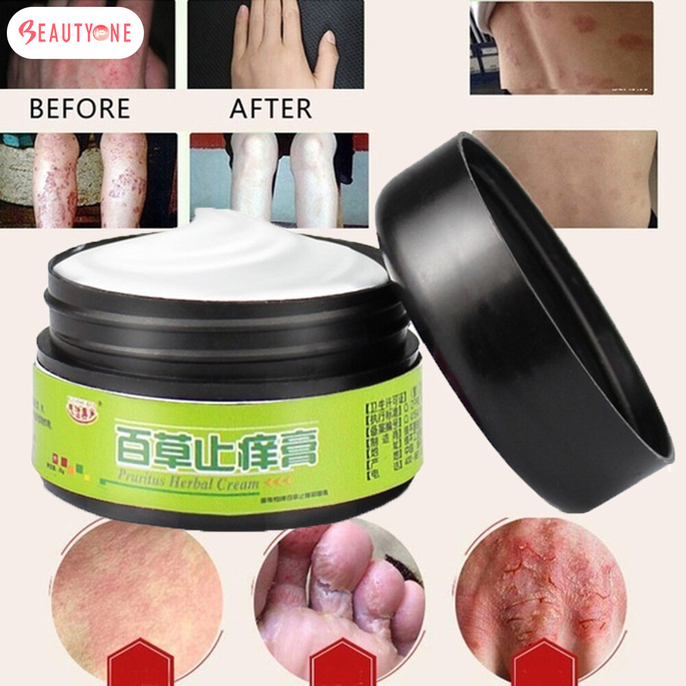 BACTEX Mupirocin Ointment แบคเท็กซ์ 15 กรัม 1หลอด EXP 2024 KhaoYai