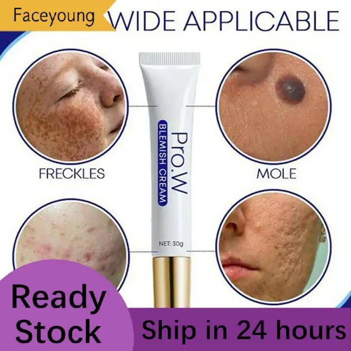 blemishes remove cream