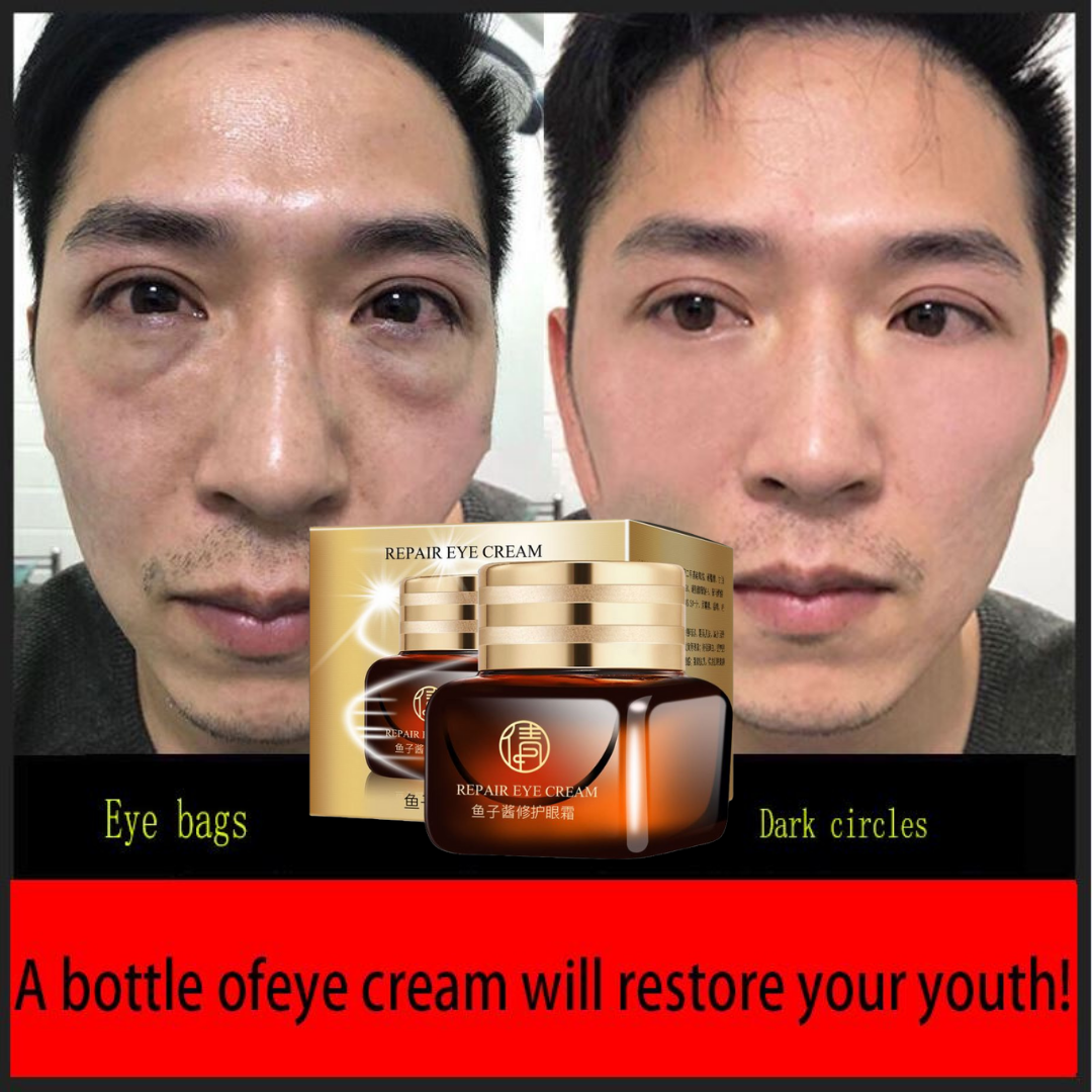Anti Wrinkle Eye Cream Eye Dark Circles Whitening Anti Aging Remove
