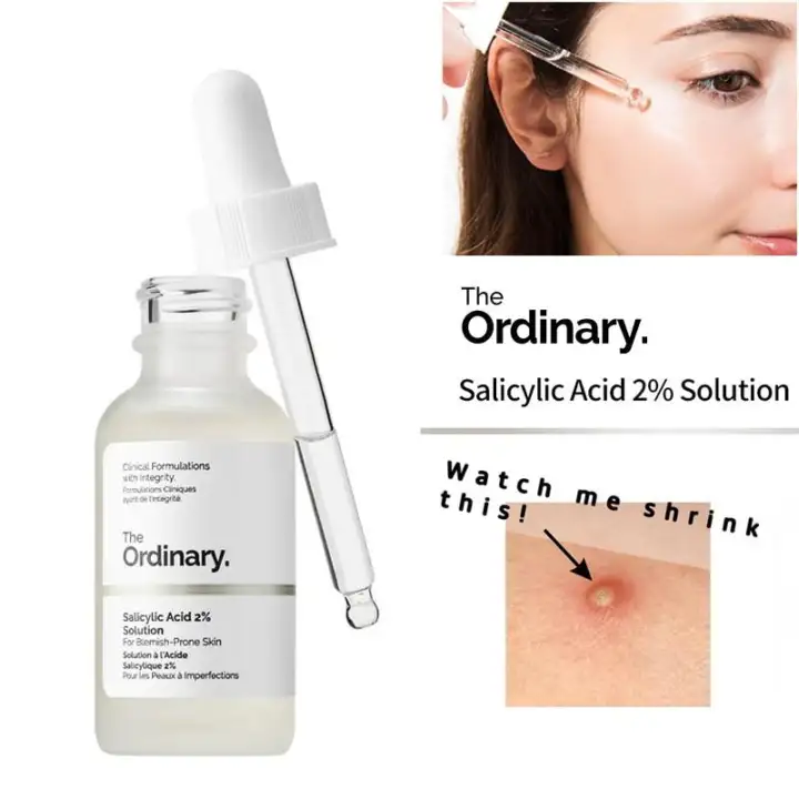 the ordinary solution for acne