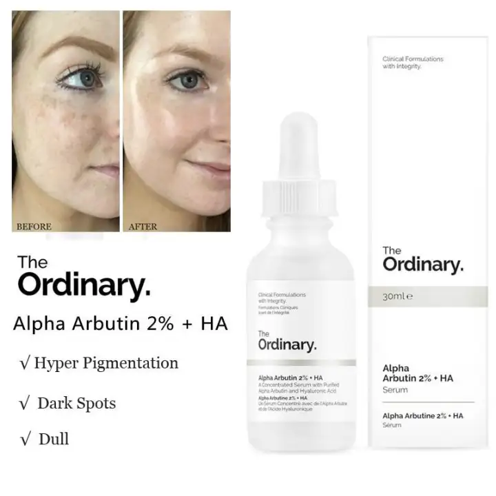 ordinary products for pigmentation