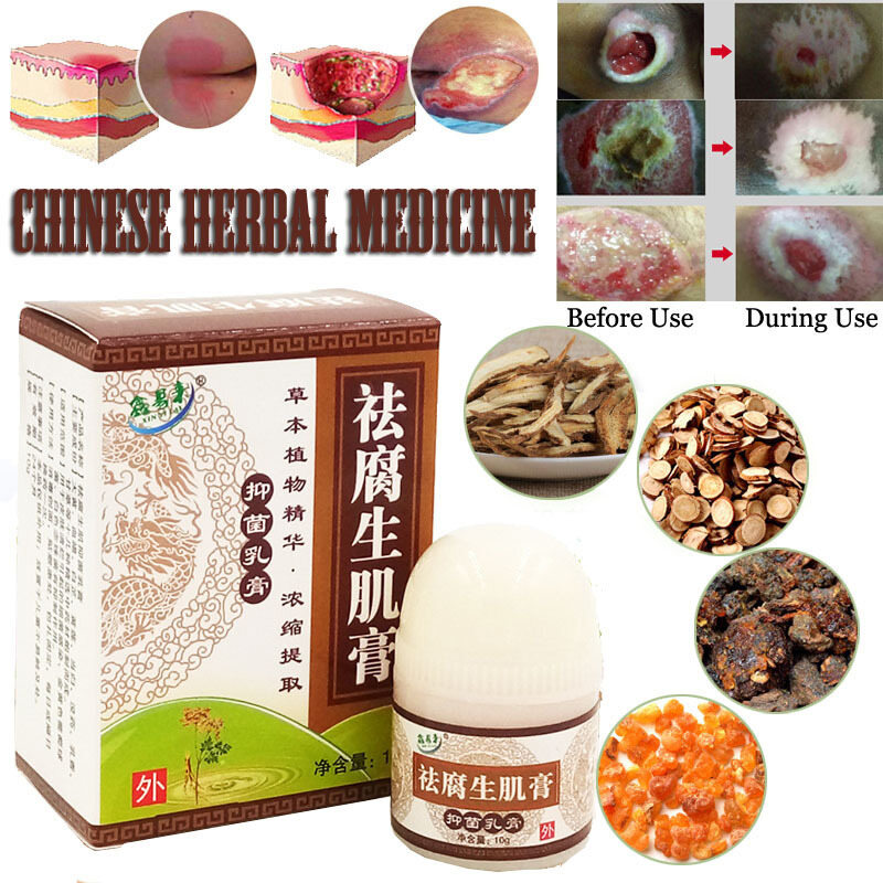 Skin healing ointment,wound Cream Bedsores Paste Treat Pressure Sores/decubituses/pressure Festering Wound Healing