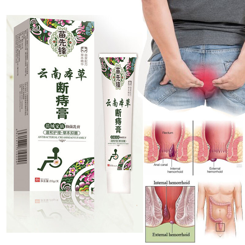 Shop Ubat Buasir Cina Online Jun 2022 Lazada Com My