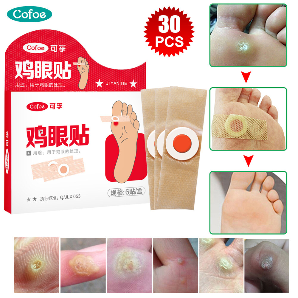 Cofoe Medical Foot Corns Remover Patch Skin Tag Feet Warts Removal ...