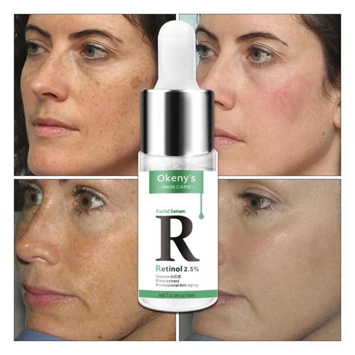 retinol on dark spots