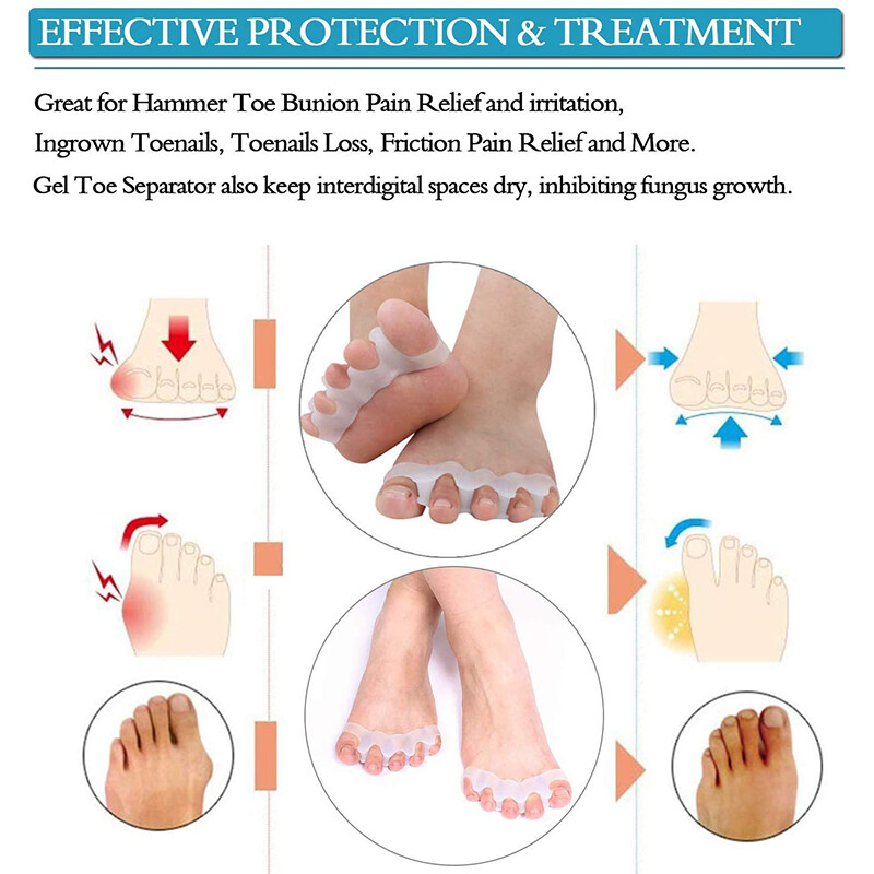 [SAWU]Toe Separator, Hallux Correction, Five-toe Separator, Toe Separator, Overlapping Toe, Bigfoot Bone Correction