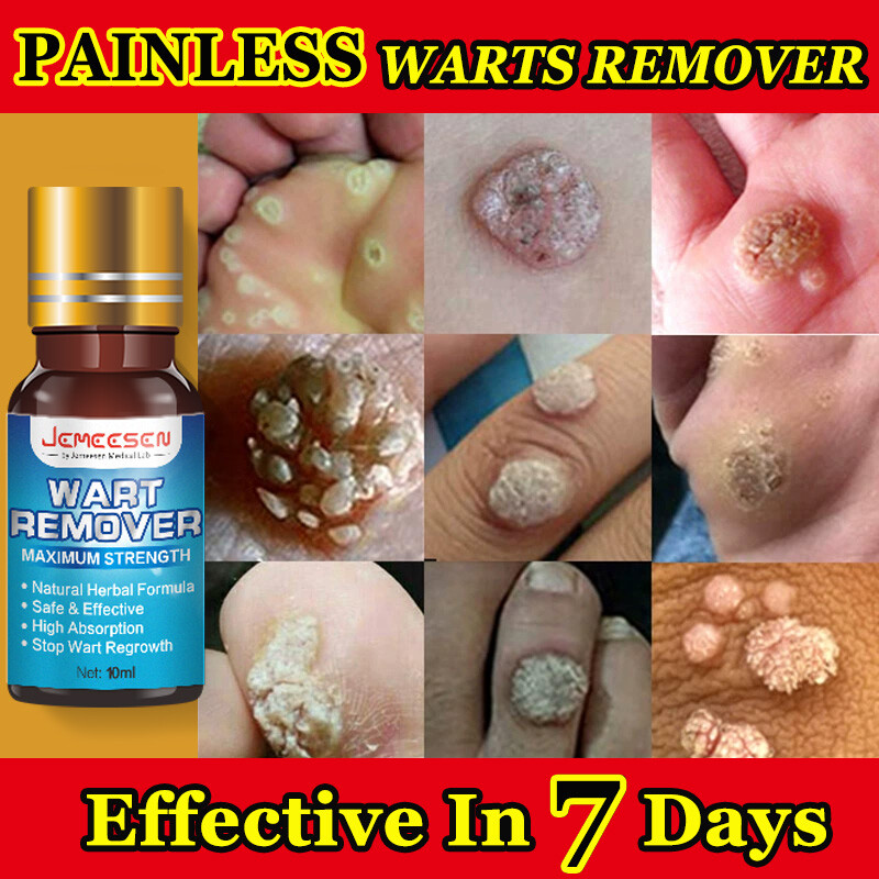 Jemeesen Wart Remover Skin Tag Remover Wart Treatment Painless Mole Skin Dark Spot Warts