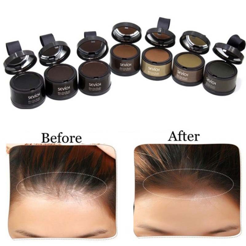 Phấn Phủ Phục Hồi Tóc Phấn Phủ Chân Tóc Phấn Phủ Thay Thế Cho Chân Tóc Trán