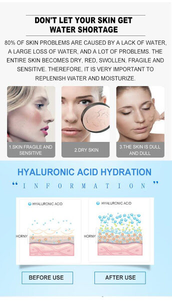 DR.RASHEL YOUTH REVITALIZING HYALURONIC ACID INSTANT HYDRATION ESSENCE ...