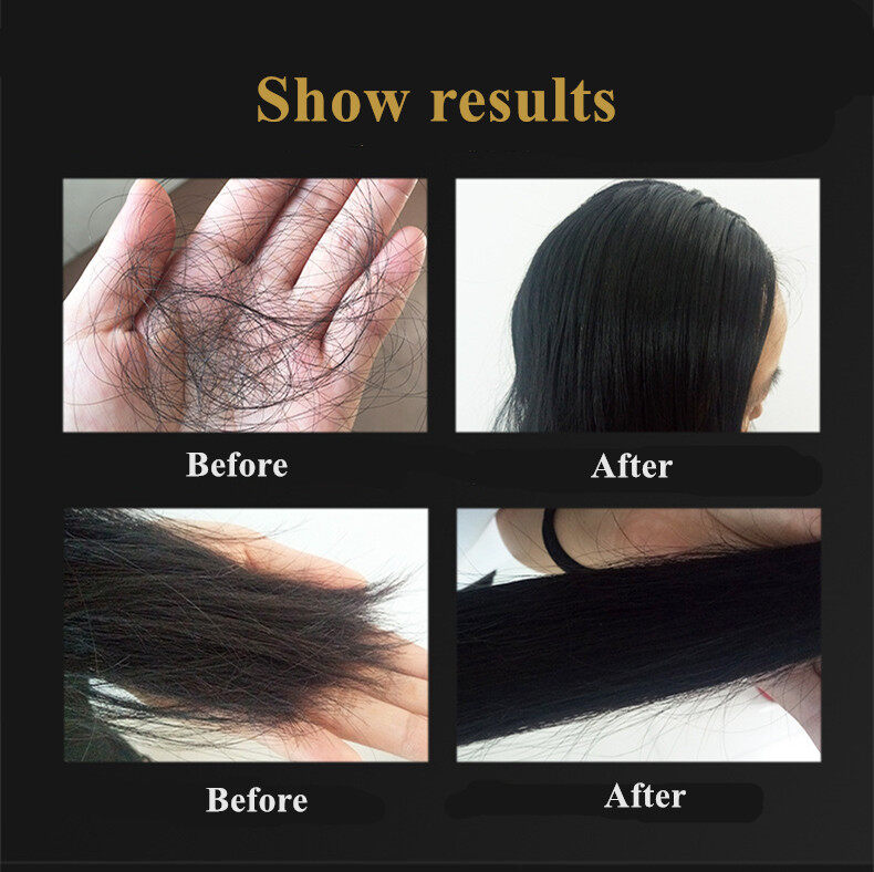 100 Original Ginger Juice Hair Shampoo Hair Growth Shampoo Anti