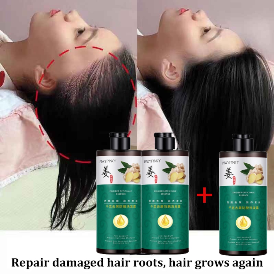 BUY 2 GET 3】New Powerful herbal essences Hair Growth Shampoo Anti Hair Loss Ginger Shampoo Oil-control repair hair roots | Lazada BUY 2 GET 3】New Powerful herbal essences Hair Growth Shampoo Anti Hair Loss Ginger Shampoo Oil-control repair hair roots | Lazada